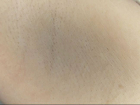 300人の腋 2　サンプル画像14